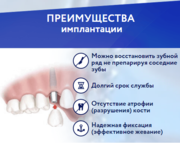 Имплантация Зубов (Корея, Израиль, Германия)другие виды по заказу 